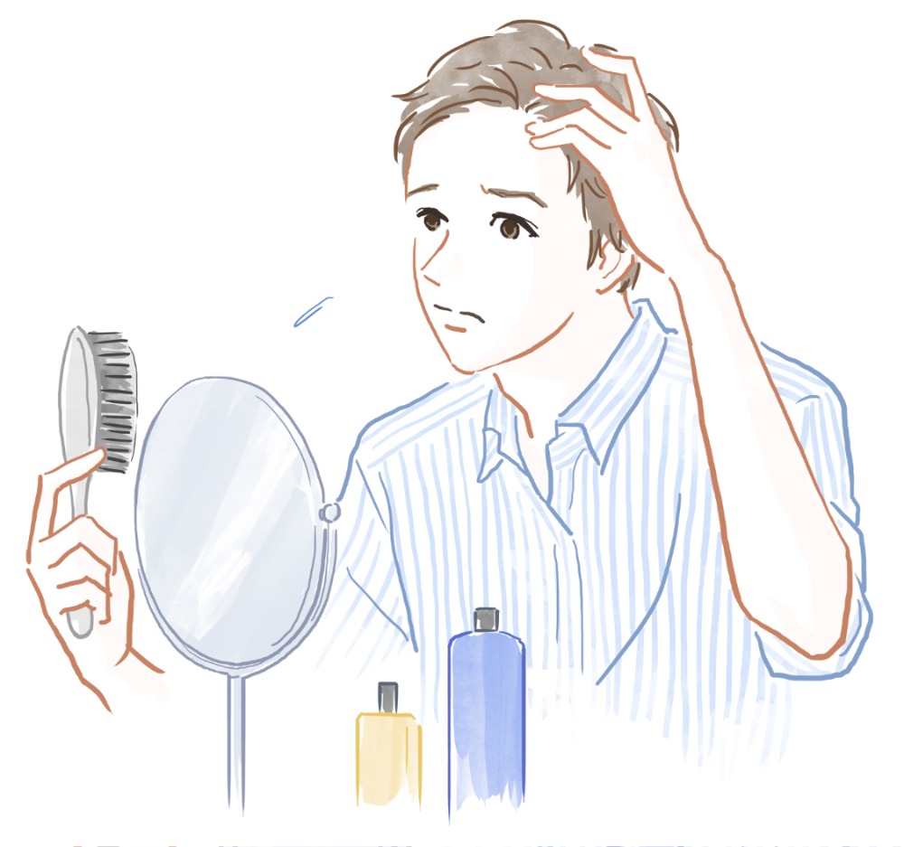 男性型脱毛症（AGA）とは